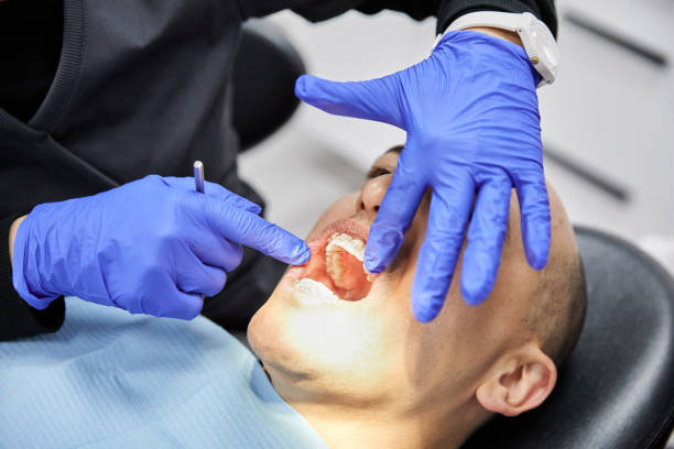 Best Emergency Dental Filling Replacement  in Gibsonburg, OH