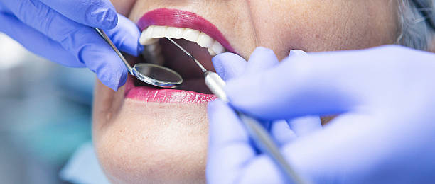 Best Root Canal Emergency Dentist  in Gibsonburg, OH