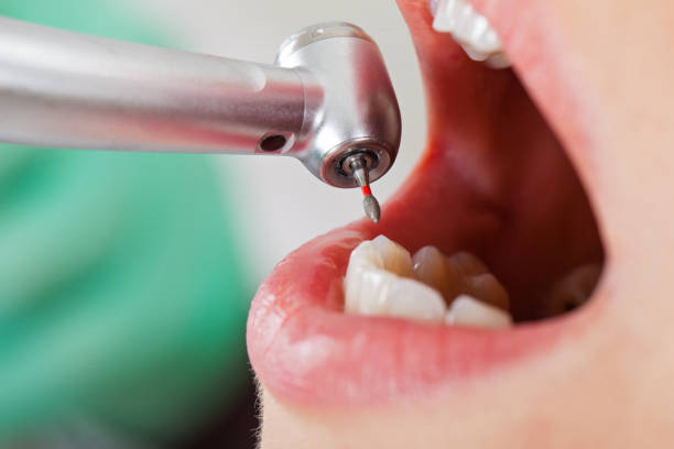 Best Cracked Tooth Emergency Dentist  in Gibsonburg, OH